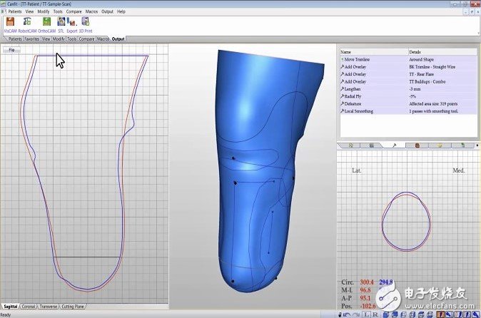 3D打印可幫助醫生設計并定制出醫療設備